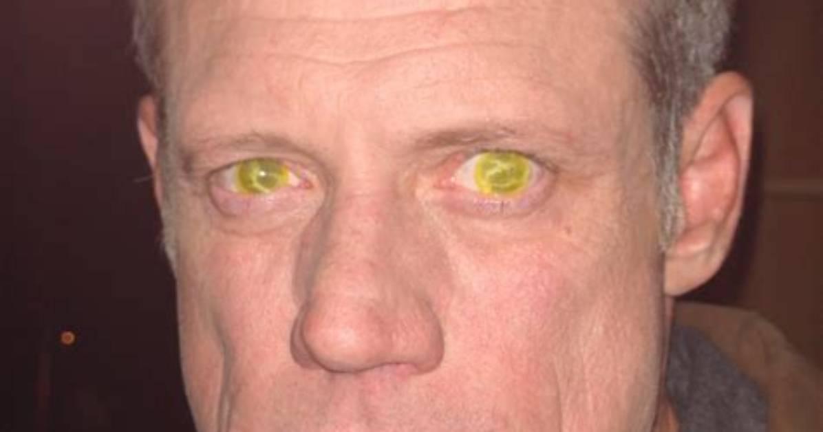 Fredric Lehne