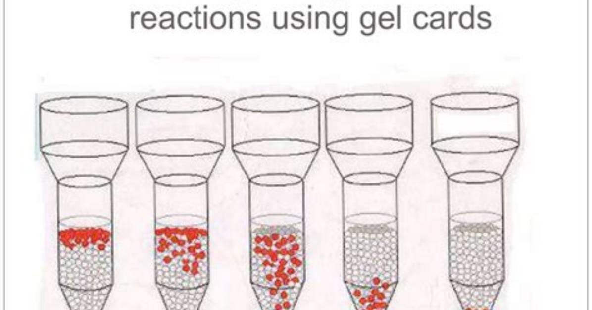 Gel Card Method