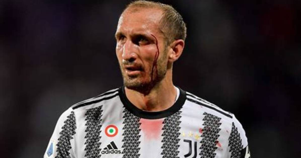 Giorgio Chiellini
