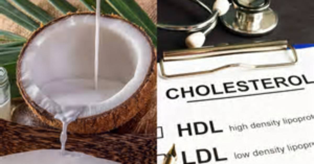 Has Coconut Milk Got Cholesterol?