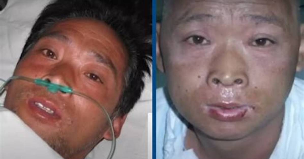 Hisashi Ouchi: Current Photographs and Work Experience in Hospitals