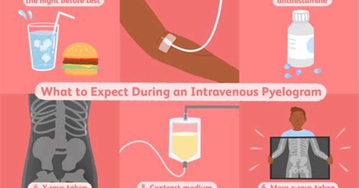 How a Pyelogram Is Done?