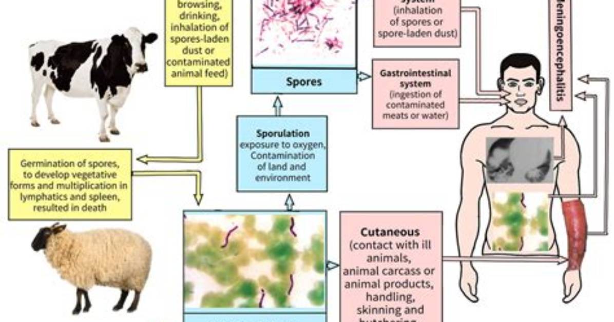 How Anthrax Is Made?