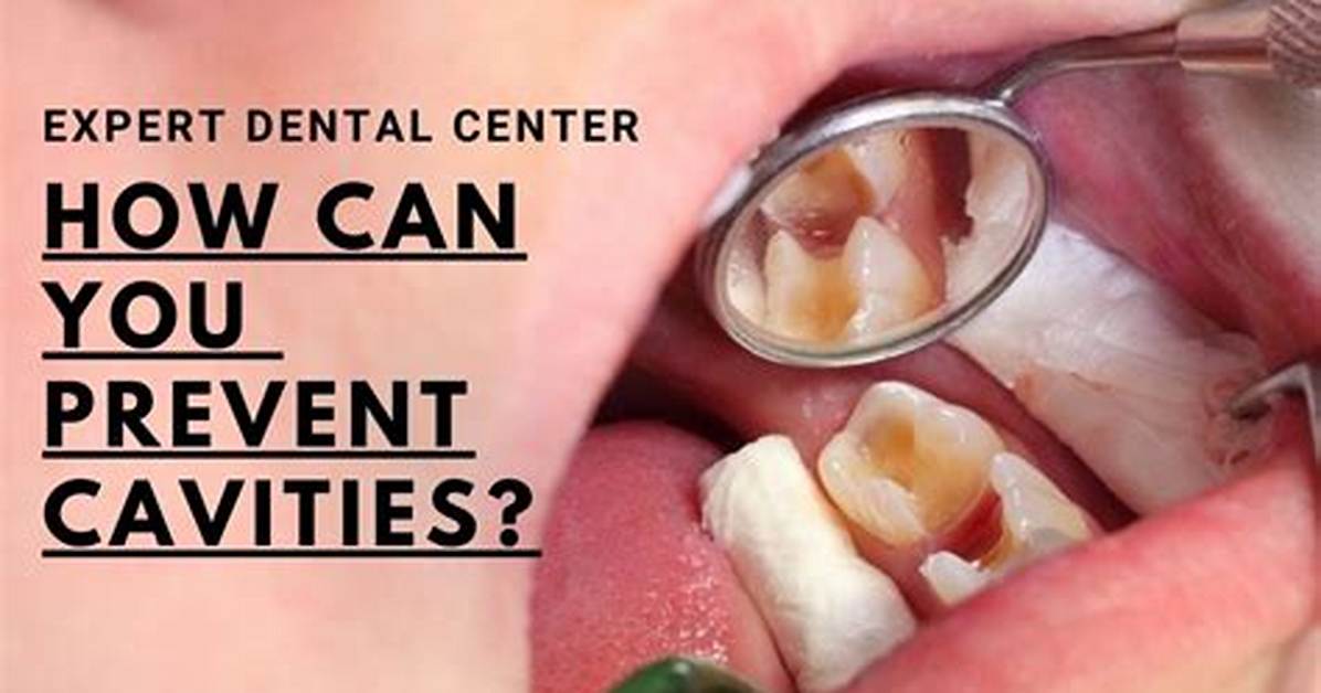 How Can You Prevent Cavities?