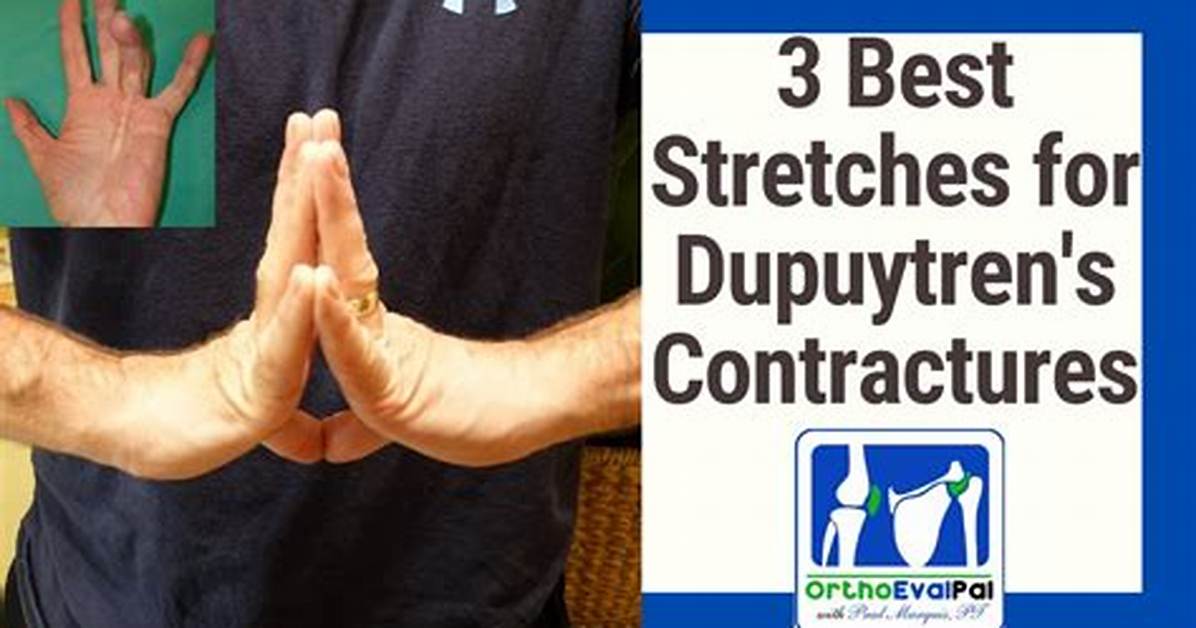 How Can You Prevent Contractures