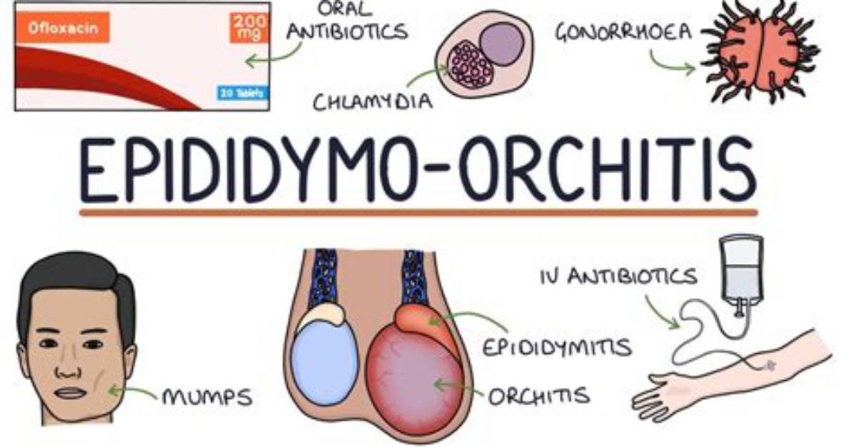 How Common Is Orchitis