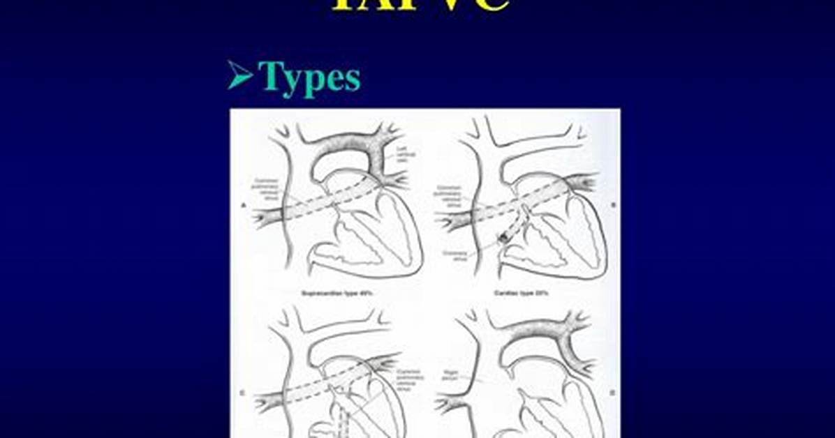 How Common Is Tapvc