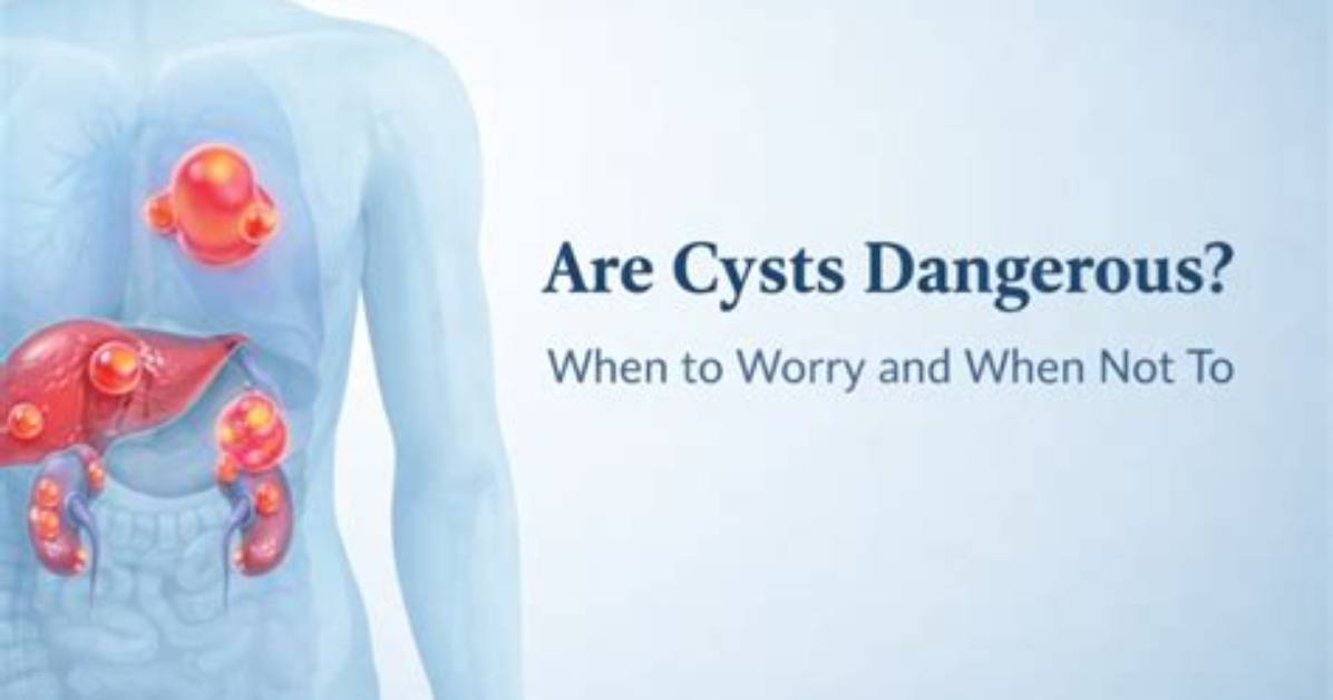 How Dangerous Are Cysts?