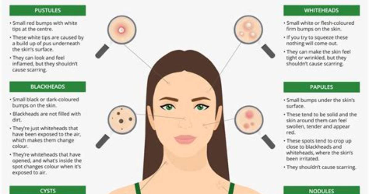 How Deep Is a Spot Face
