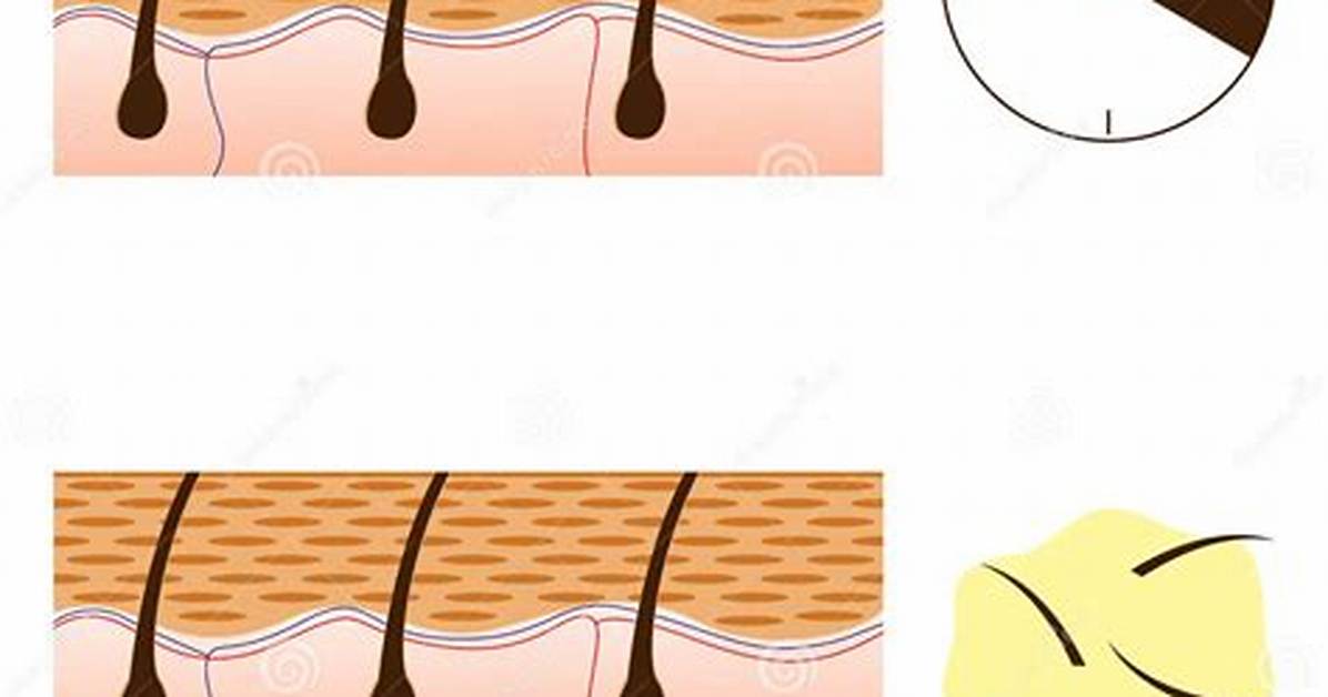 How Do Depilatories Work?
