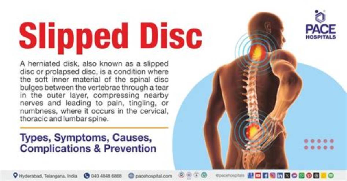 How Do Doctors Check for Slipped Disc?
