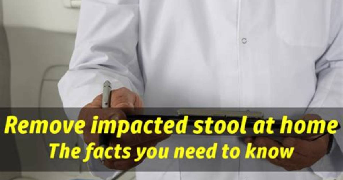 How Do Doctors Manually Remove Impacted Stool?