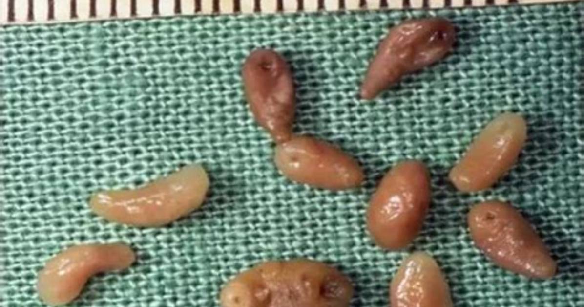 How Do Dogs Get Trematodes
