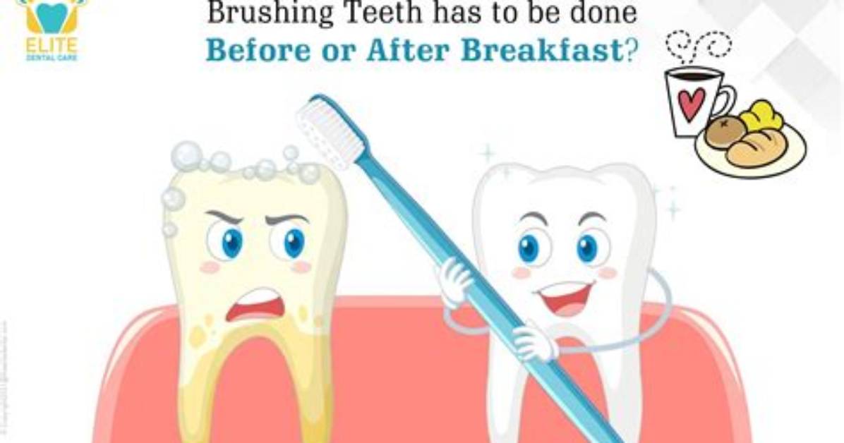 How Do I Cast My Teeth