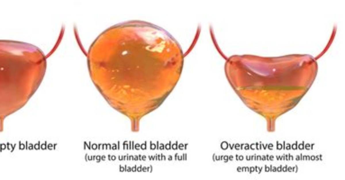 How Do I Completely Empty My Bladder Male?