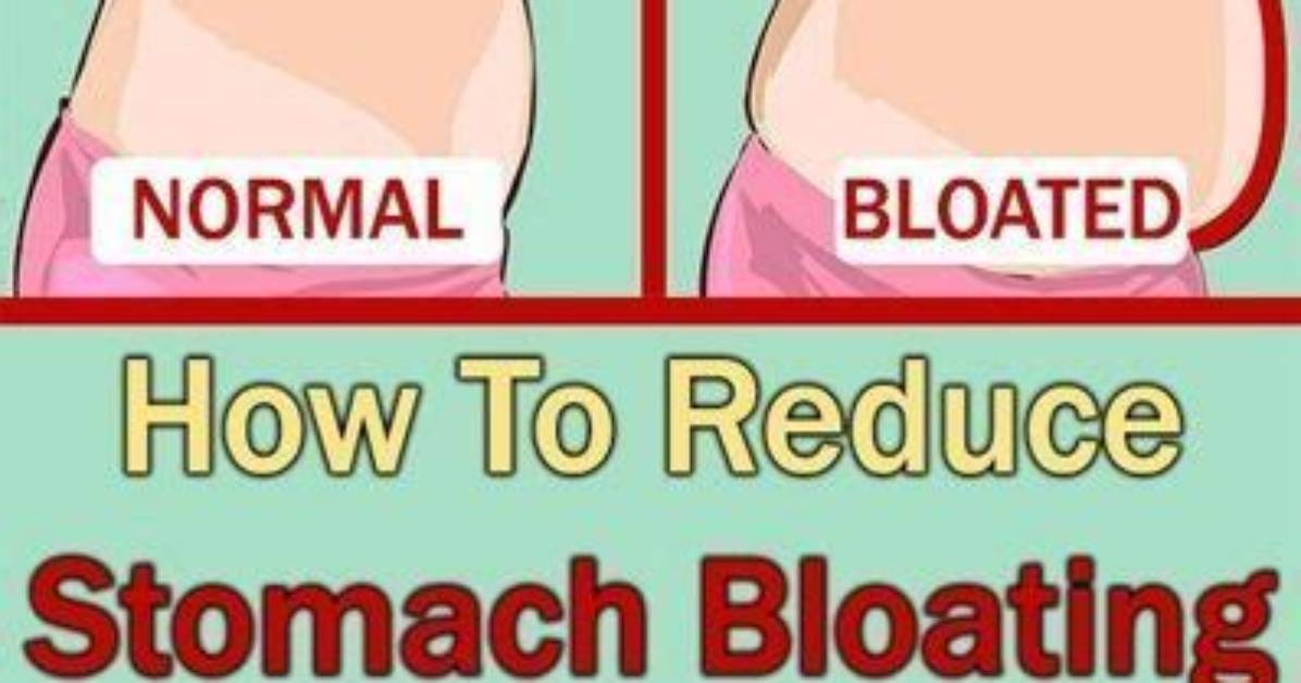 How Do I Fix Severe Bloating