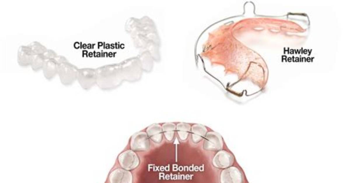 How Do I Get a Retainer in Ffxiv?