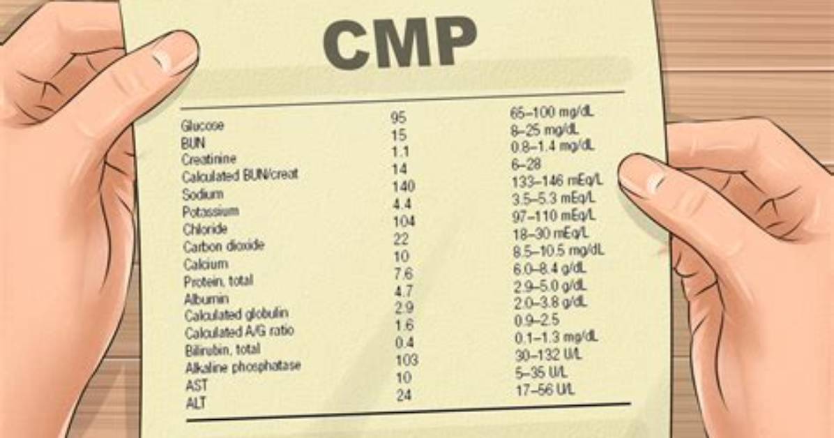 How Do I Get My Cmp?