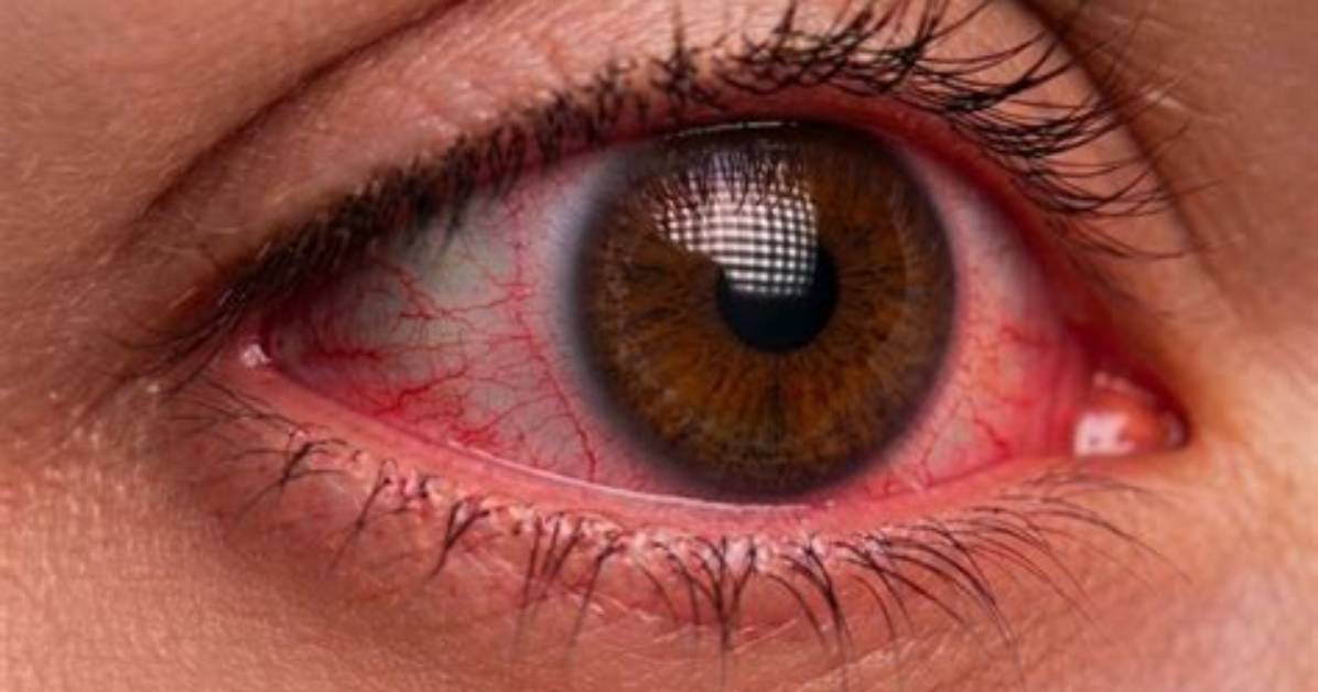 How Do I Get My Contacts from My Old Android Phone?