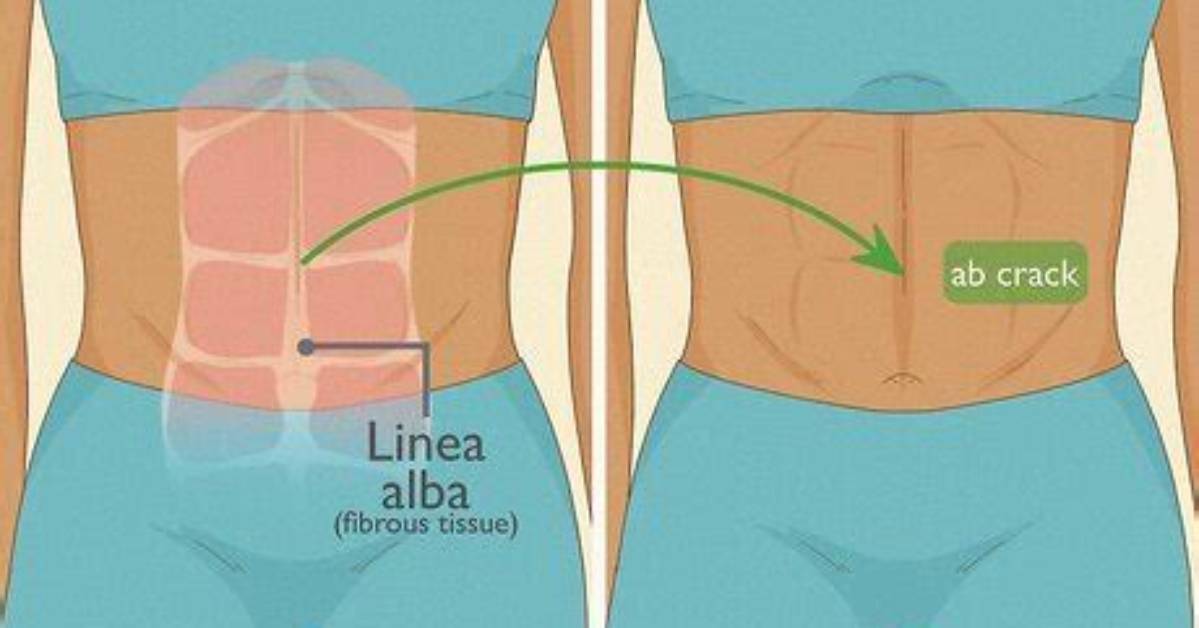 How Do I Have an Ab Crack?