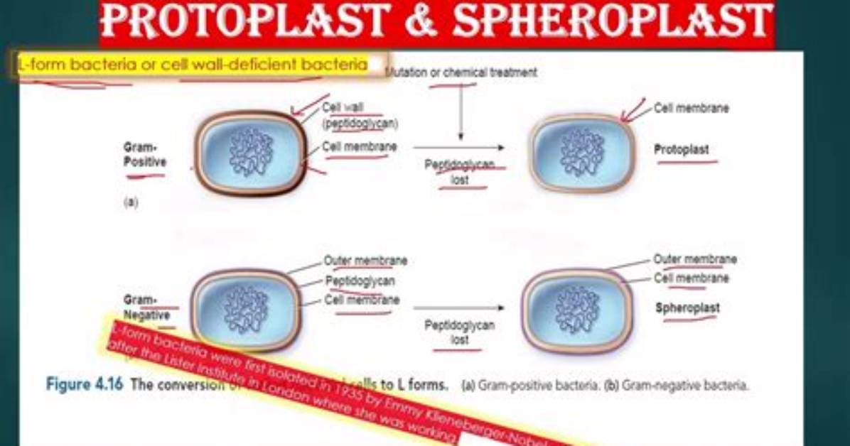 How Do Spheroplast and Protoplast Difference?