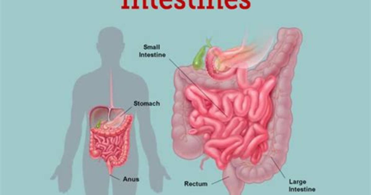 How Do They Unblock Intestines?