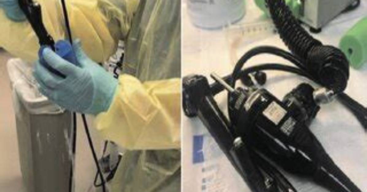 How Do You Clean a Bronchoscope?