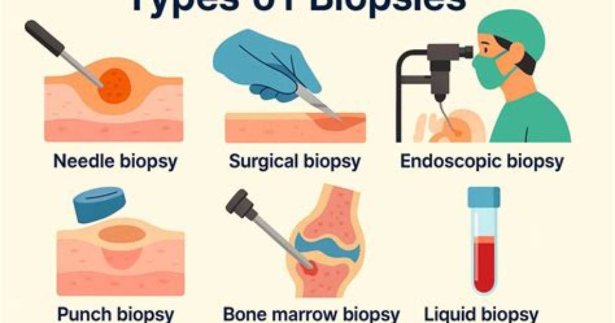 How Do You Code a Biopsy