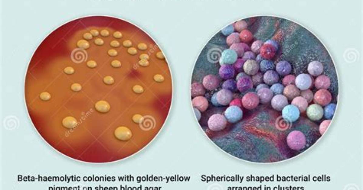 How Do You Differentiate Between S. Aureus and S. Epidermidis?