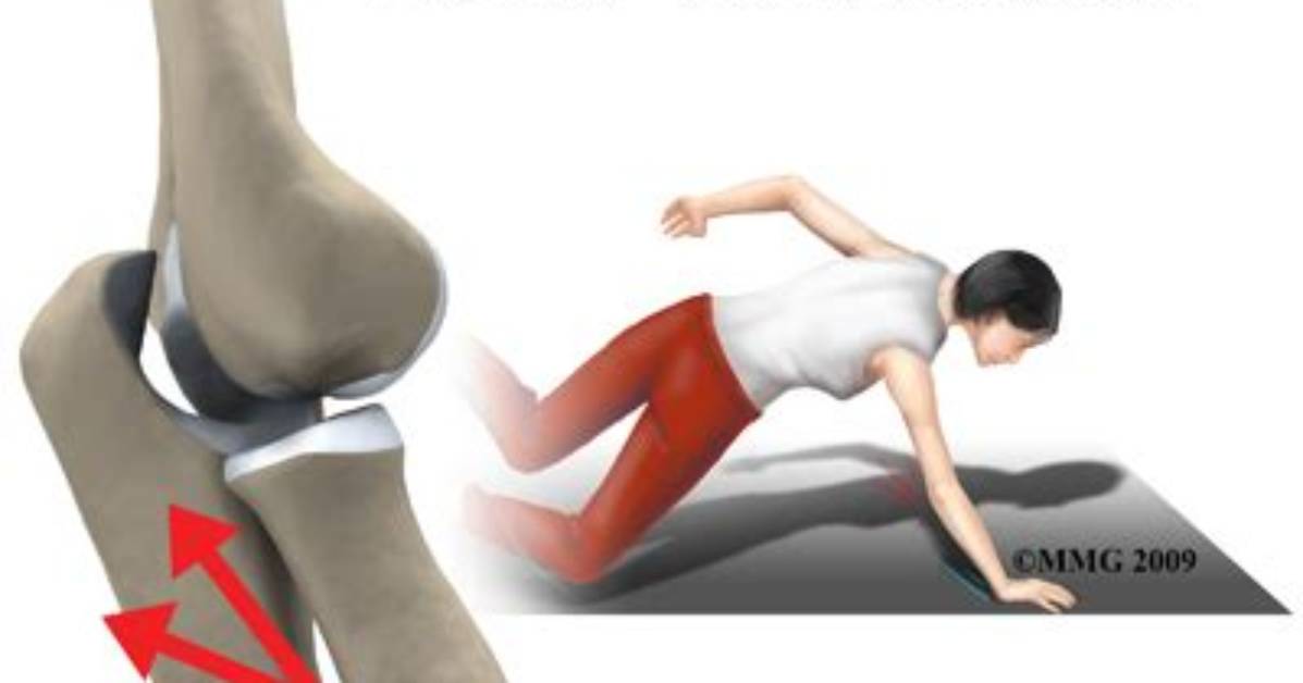 How Do You Dislocate Elbow?