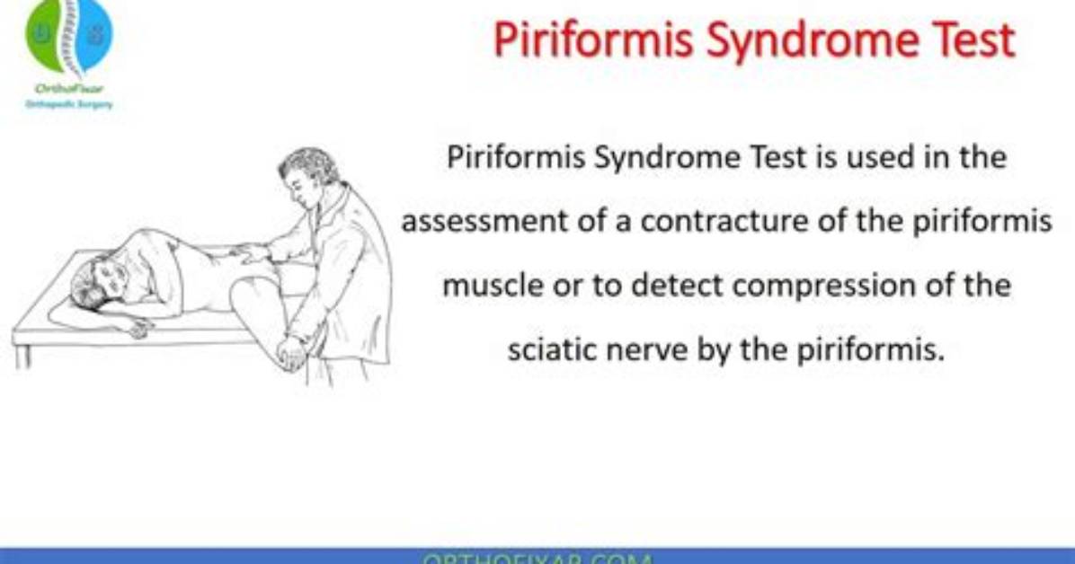 How Do You Do a Piriformis Test