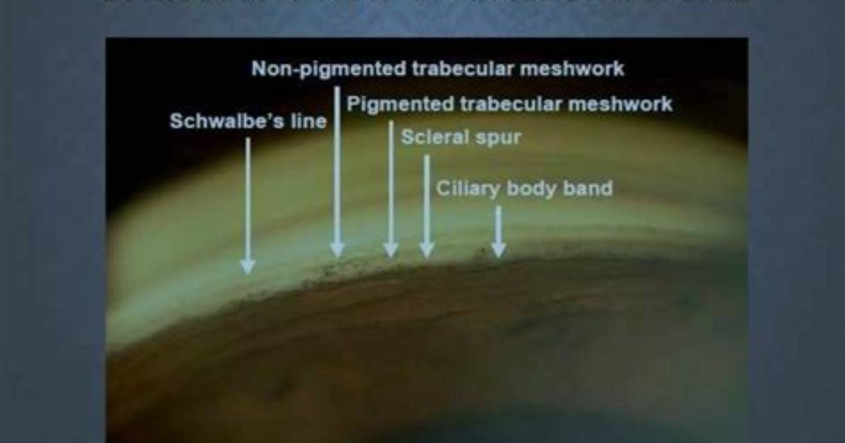 How Do You Document a Gonioscopy