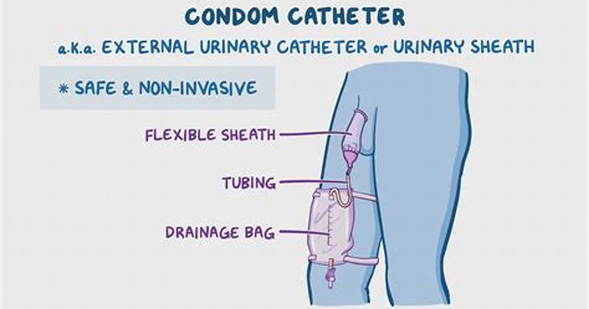 How Do You Fix a Condom Catheter