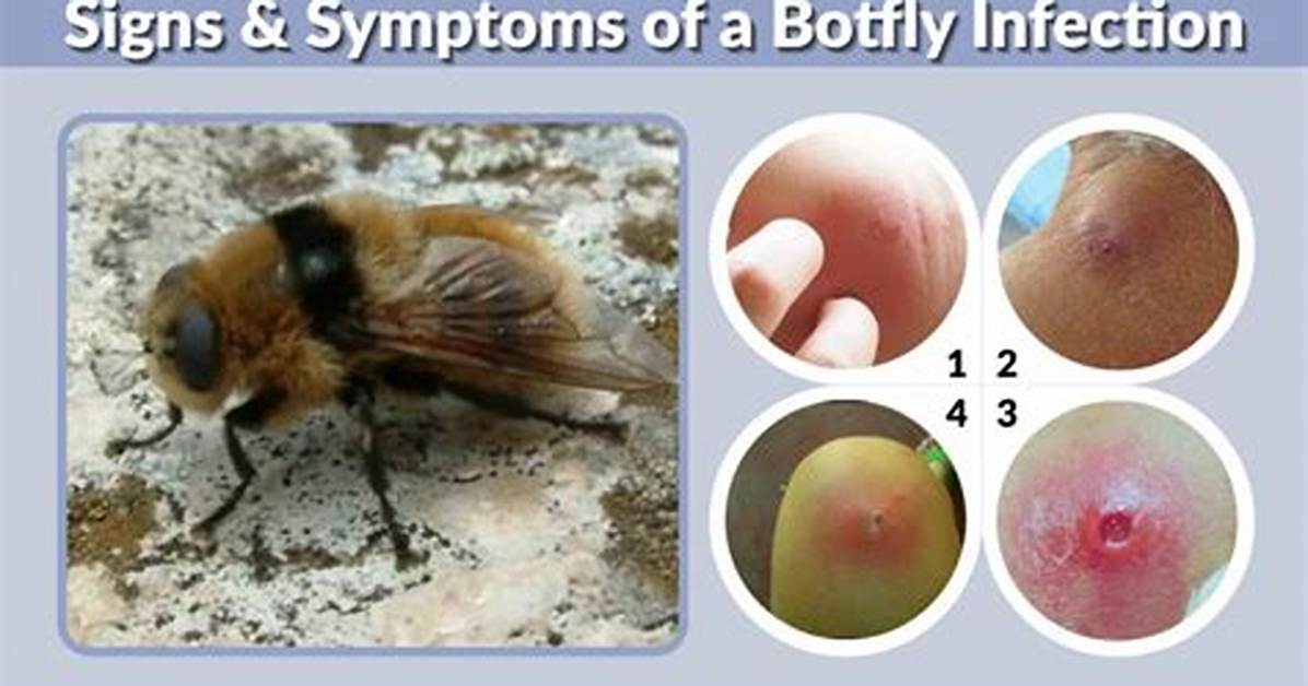How Do You Get a Botfly Infection