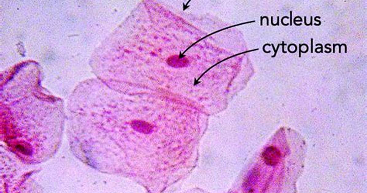 How Do You Identify a Cheek Cell