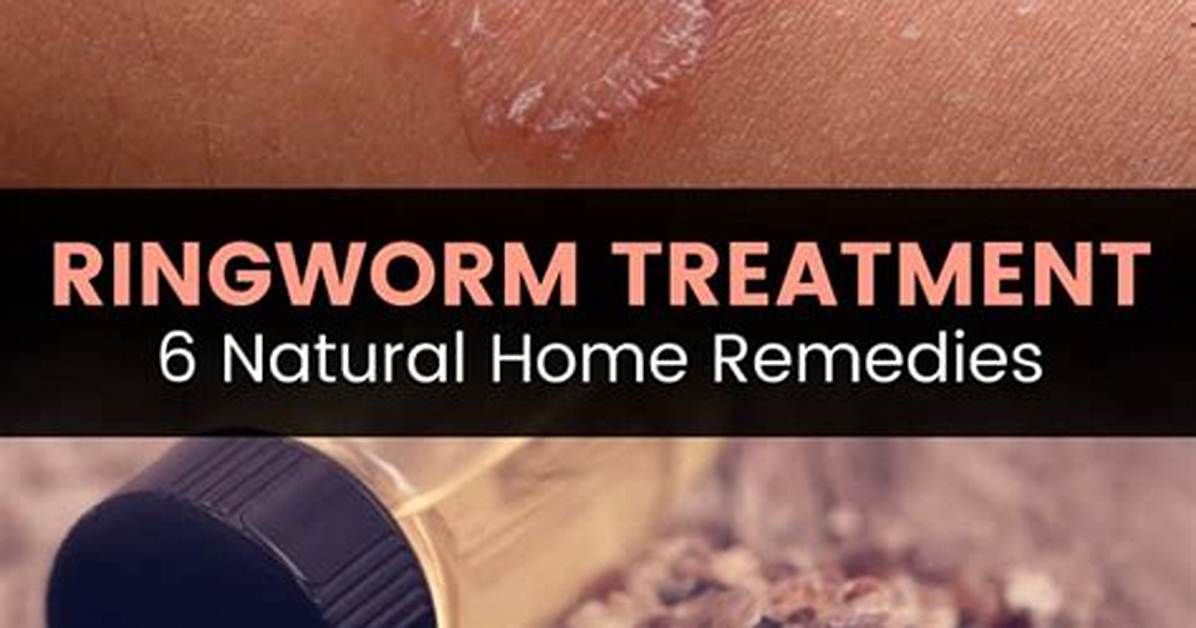 How Do You Kill Ringworm Spores