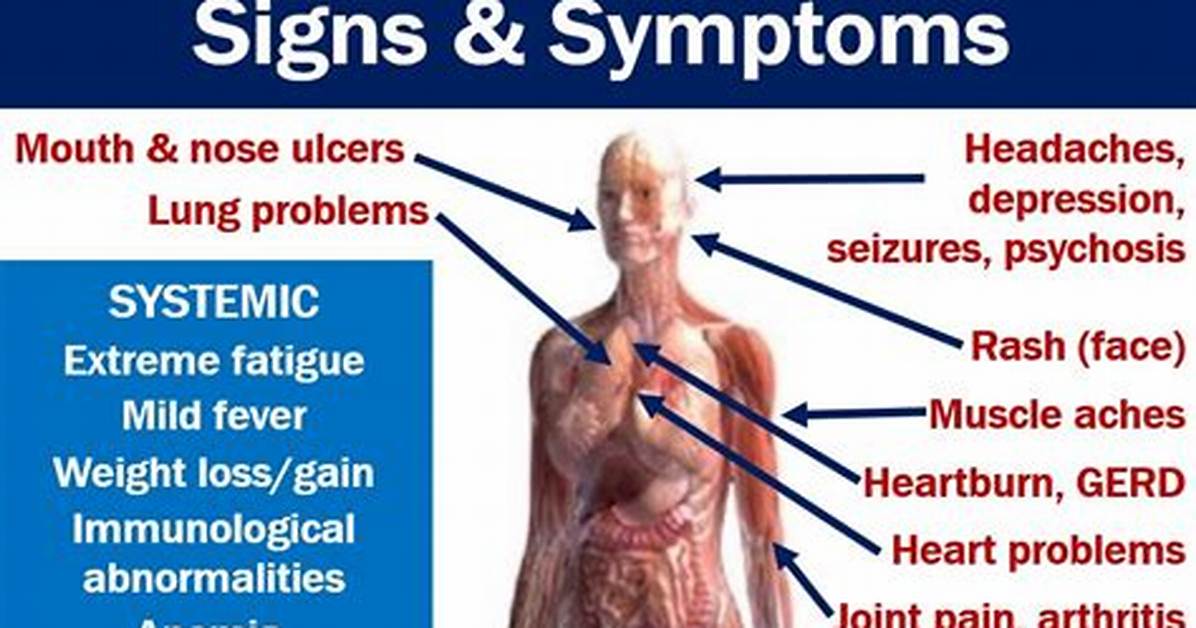 How Do You Know If Lupus Is Active?