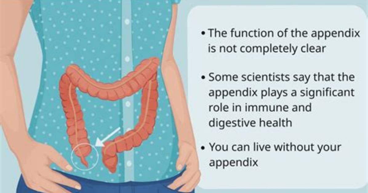 How Do You Know If Your Appendix Has Burst?