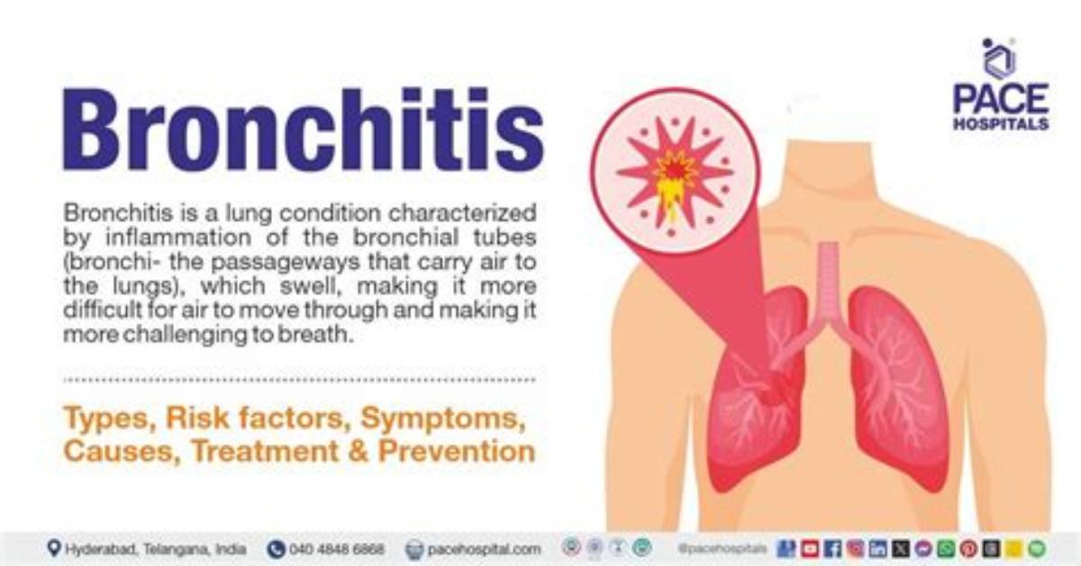 How Do You Know When Bronchitis Is Going Away?