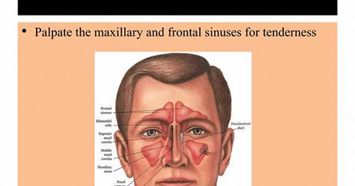 How Do You Palpate Sinuses