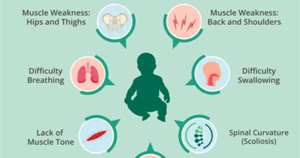 How Do You Prevent Sma