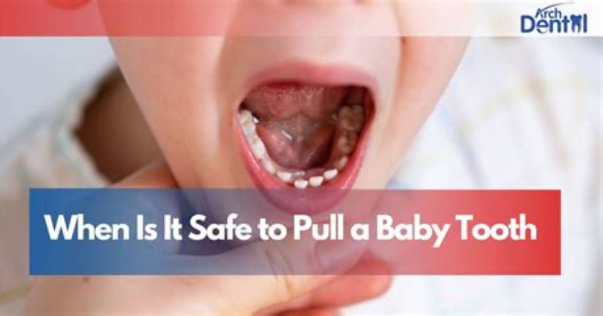 How Do You Pull a Baby Tooth?