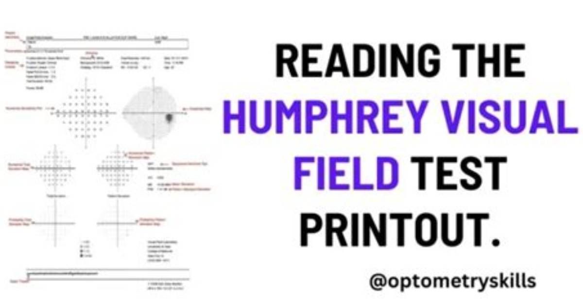 How Do You Read the Humphrey Visual Field Test
