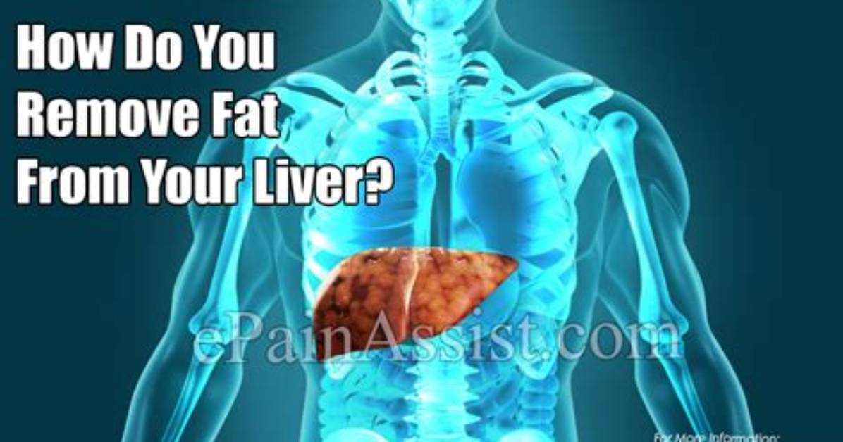 How Do You Remove Fat from Your Liver?