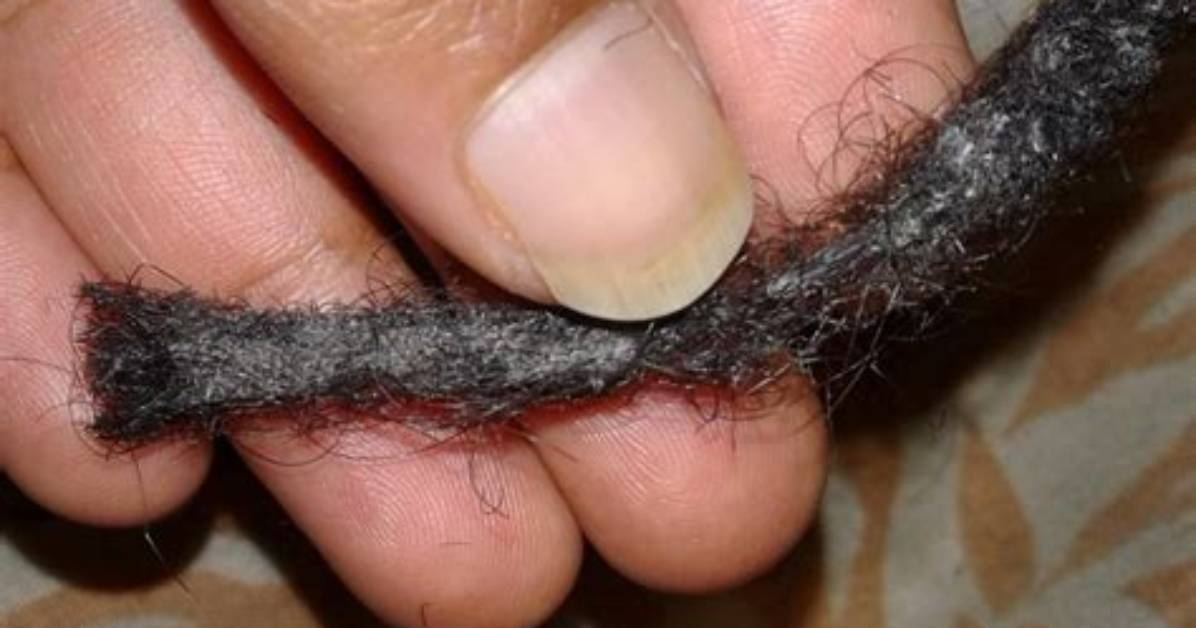 How Do You Remove Mold from Dreads?