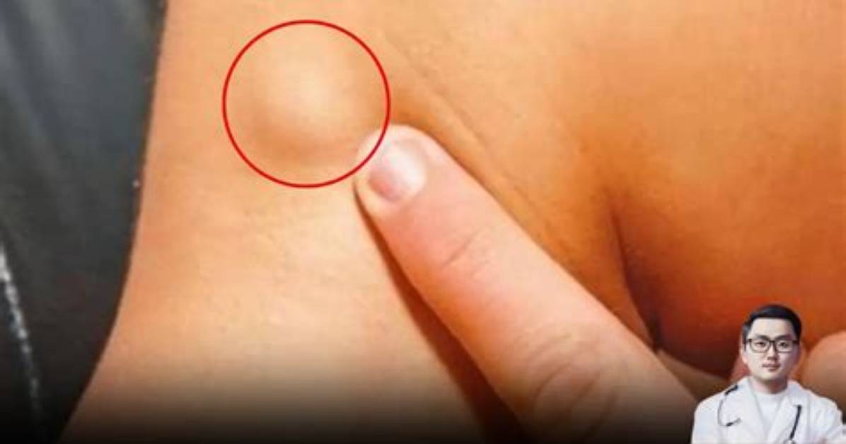 How Do You Tell If a Lump Is a Tumor?