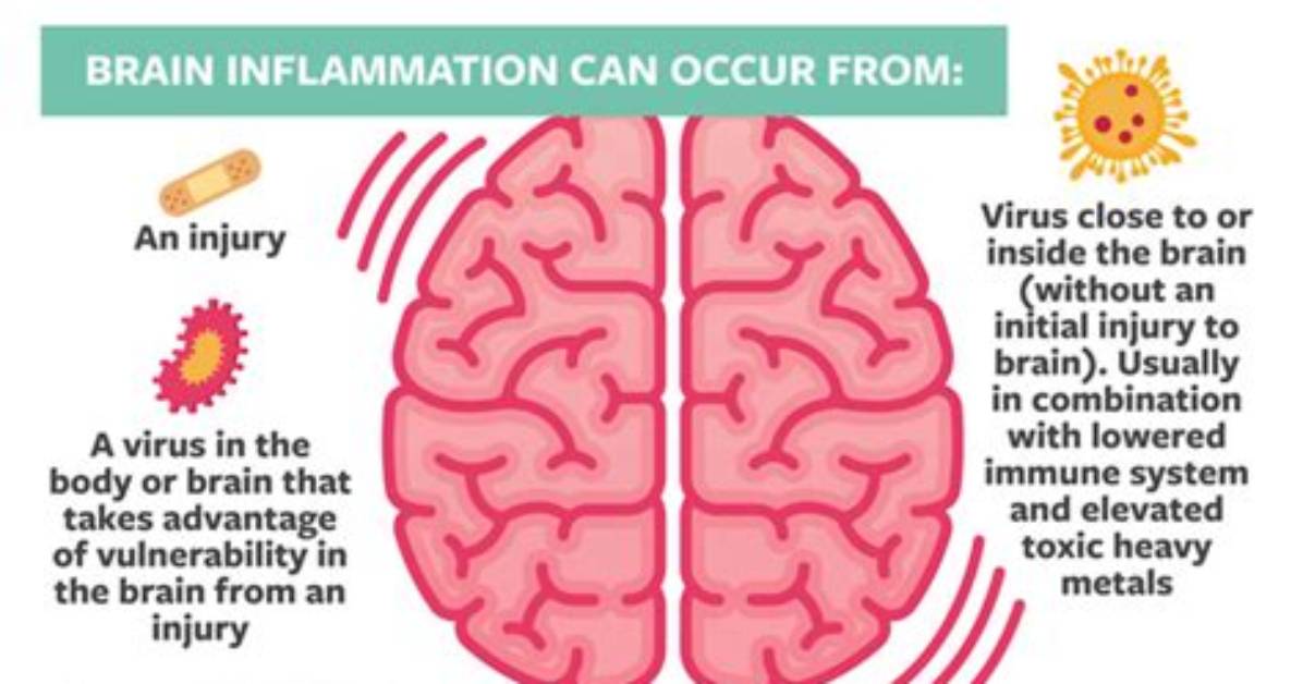 How Do You Test for Brain Inflammation?