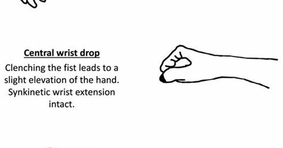How Do You Test for Wrist Drop?