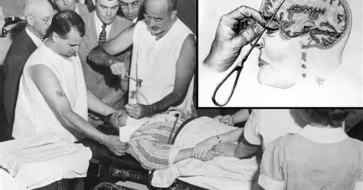 How Does a Lobotomized Person Act?