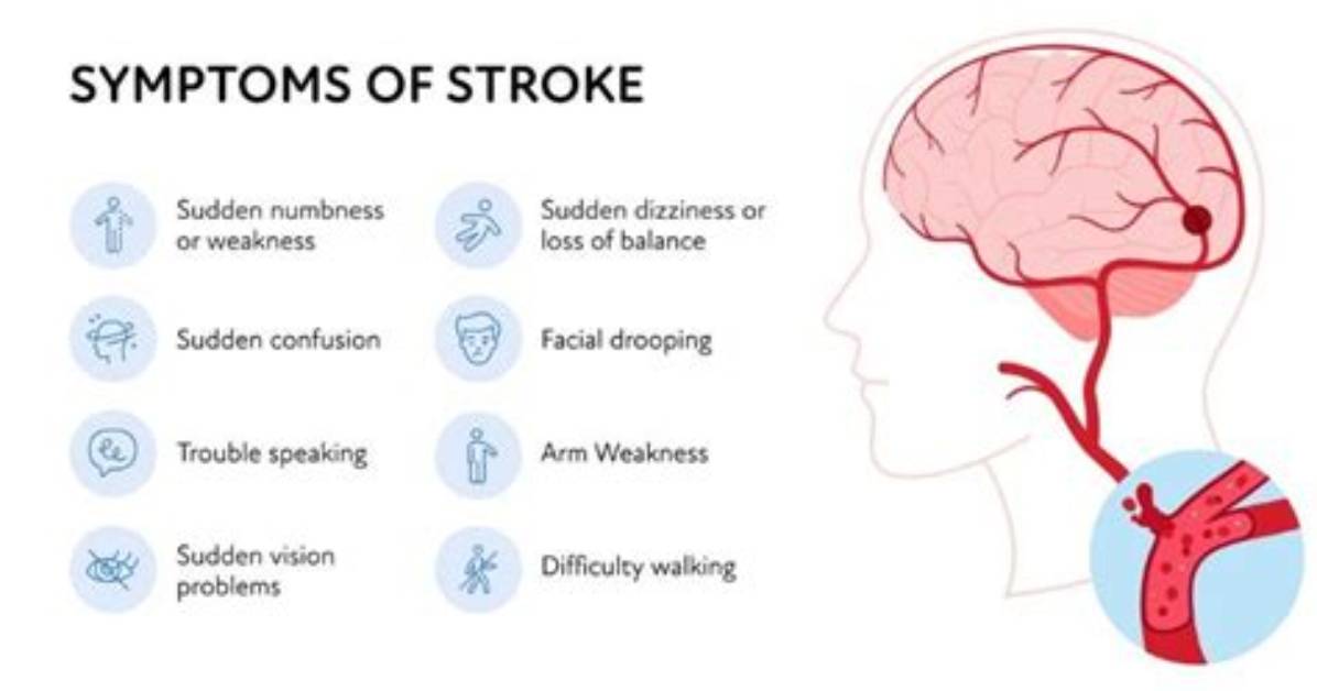 How Does a Stroke Patient Feel?